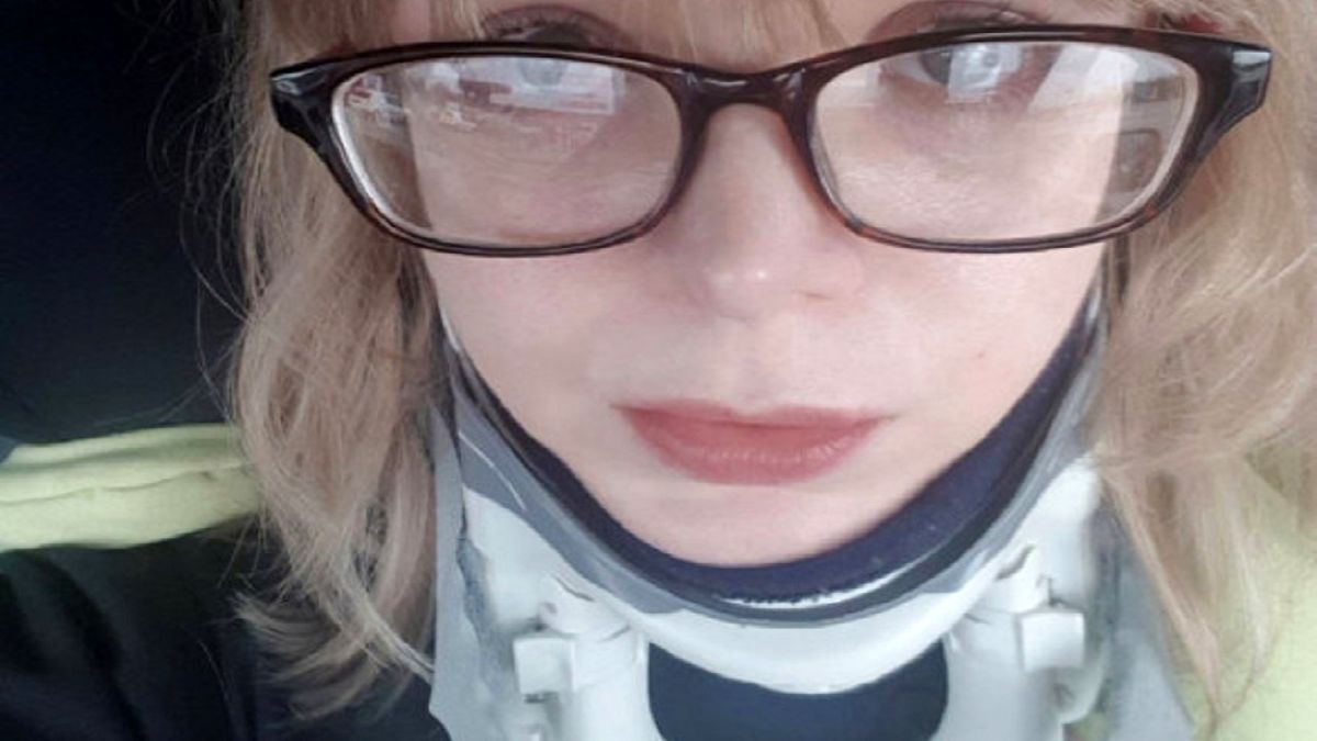 بیماری عجیب دختری که باعث جداشدن سر از بدنش شد + عکس