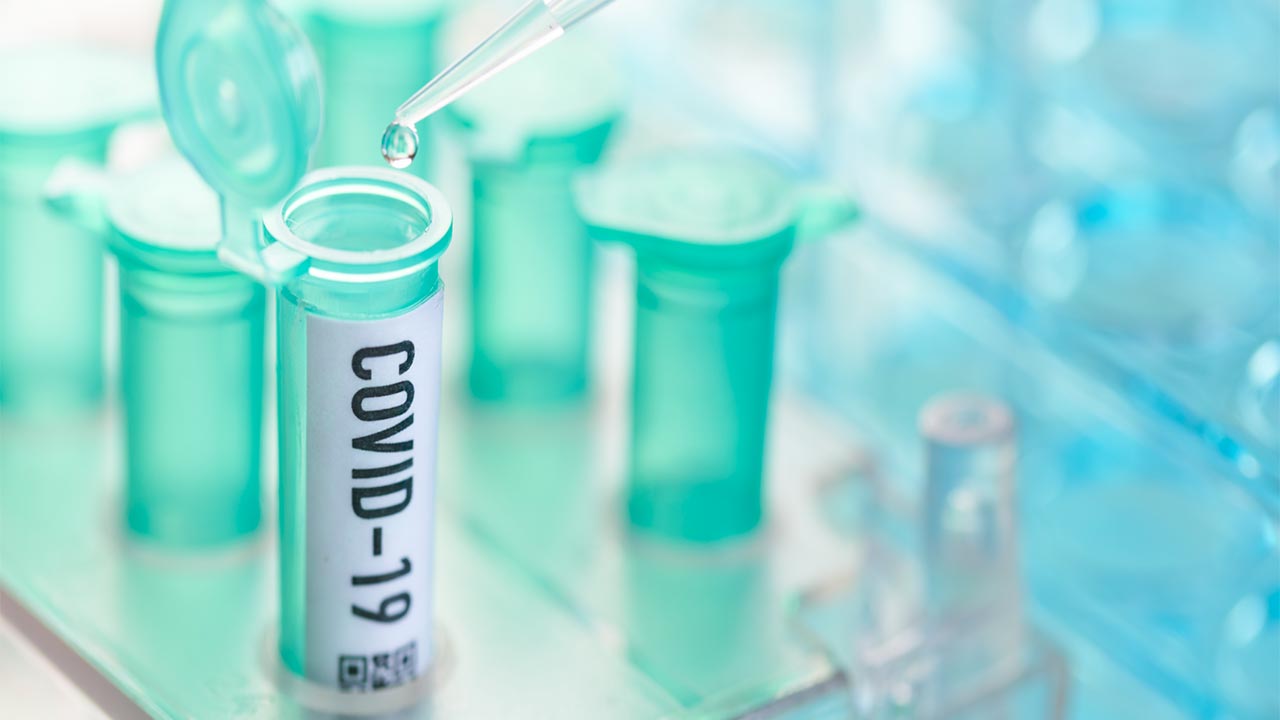 اولین مورد ابتلا به کرونای انگلیسی دراین شهر تایید شد