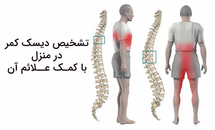 تشخیص علائم دیسک کمر و معاینات پزشکی لازم