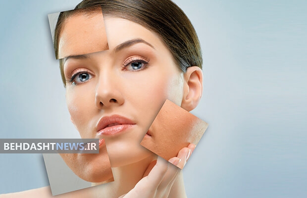 مزوتراپی چیست ؟