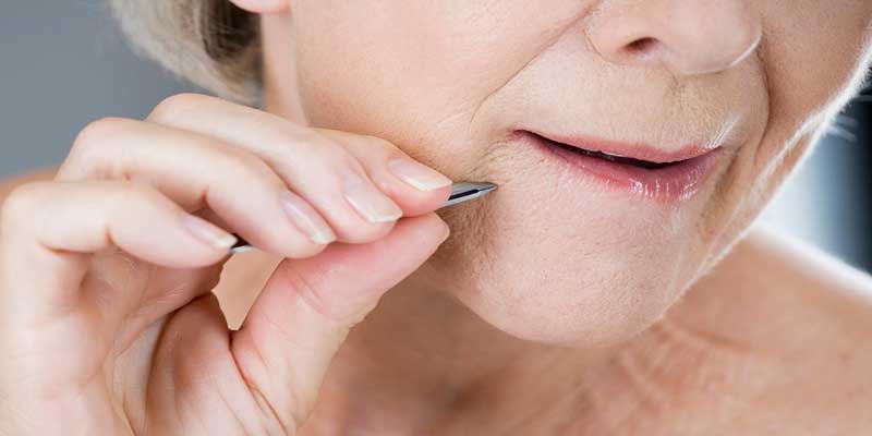 موهای زائد چانه نشانه چیست؟