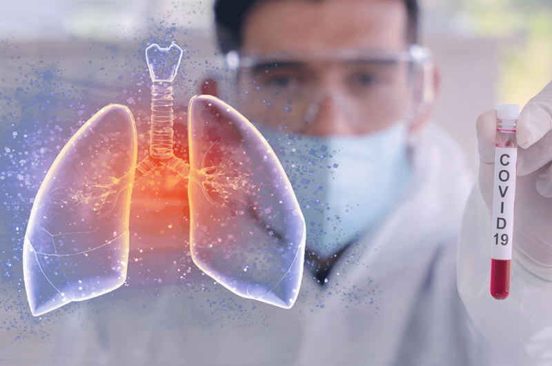 درباره اثرات منفی و بلندمدت کووید-۱۹  بر روی ریه بیشتر بدانیم