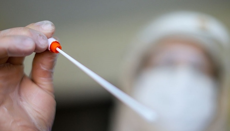  تفاوت ویروس آفریقایی با دیگر ویروس‌های کرونا