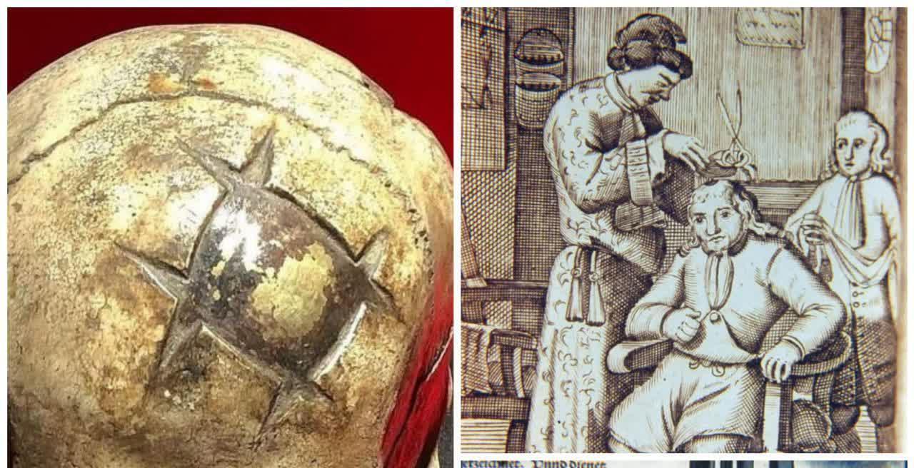 جراحی حیرت انگیز جمجمه در ۱۶۰۰ سال پیش + عکس