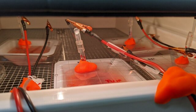 درمان تومورهای بدخیم مغز با یک روش جدید