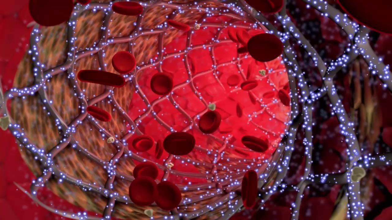  ۵ باور اشتباه درباره سرطان که باید نادیده بگیرید