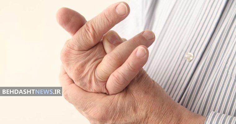 نشانه های آرتریت یا ورم مفاصل