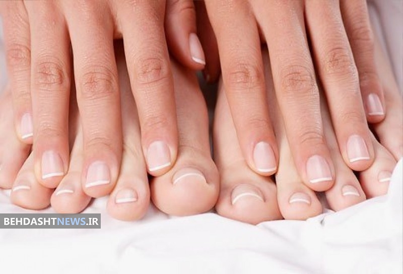 مشکلات ایجاد شده برای ناخنها