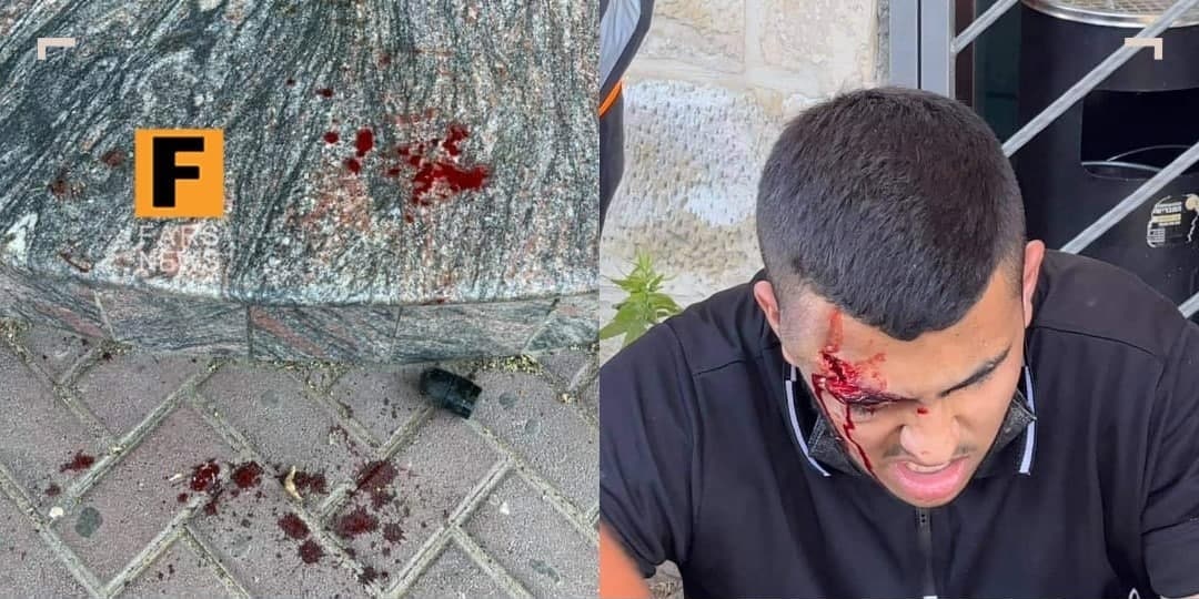 شلیک به جوان فلسطینی از فاصله صفر! + عکس