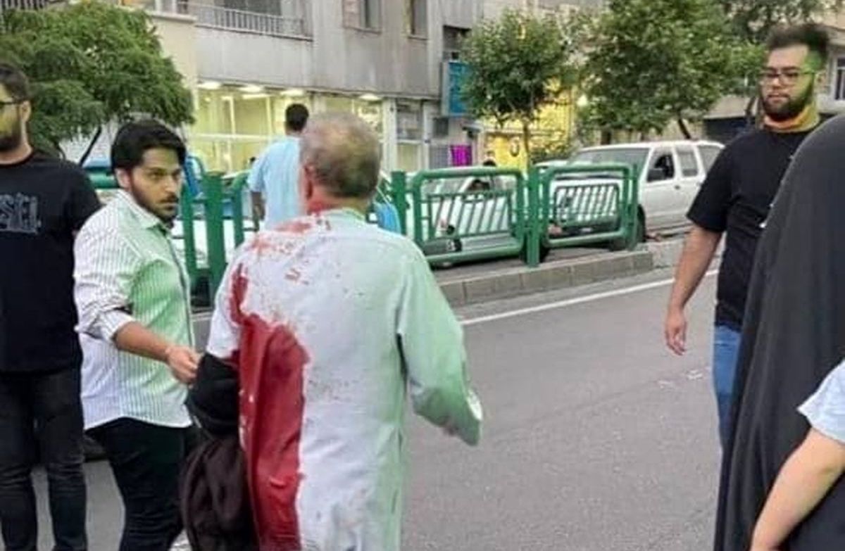 حمله اراذل و اوباش به یک روحانی در تهران! + عکس