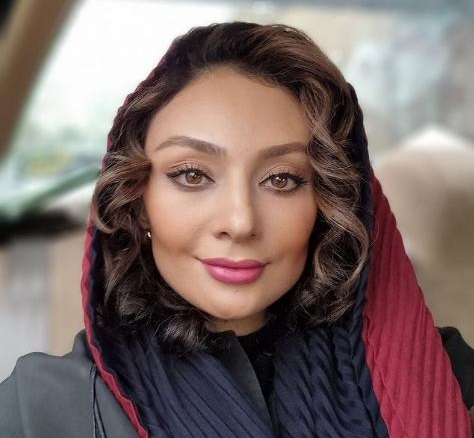 چهره عجیب یکتا ناصر پس از انجام جراحی زیبایی + عکس