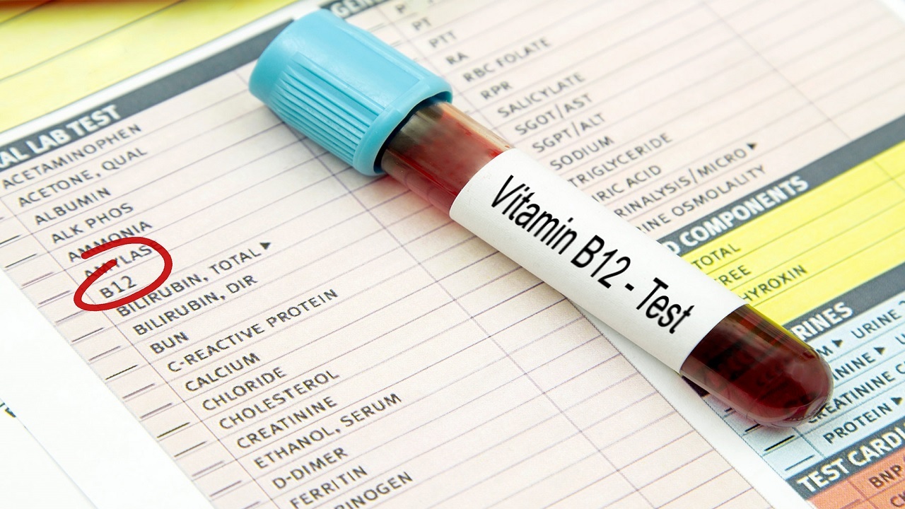هشدار: کمبود ویتامین B12 سبب این بیماری خطرناک می شود!