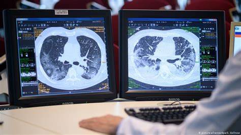 چگونه از ریه ها در مقابل کرونا محافظت کنیم؟