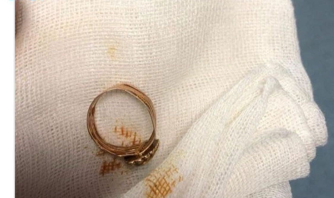 عکس تکان‌دهنده پرستار از یک بیمار ایرانی