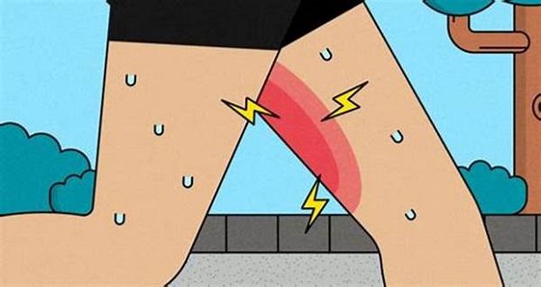 با راه‌های پیشگیری و درمان عرق‌سوز شدن آشنا شوید