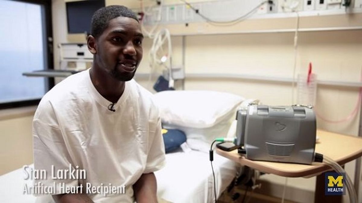 مردی که ۵۵۵ روز بدون قلب زندگی کرد! + عکس