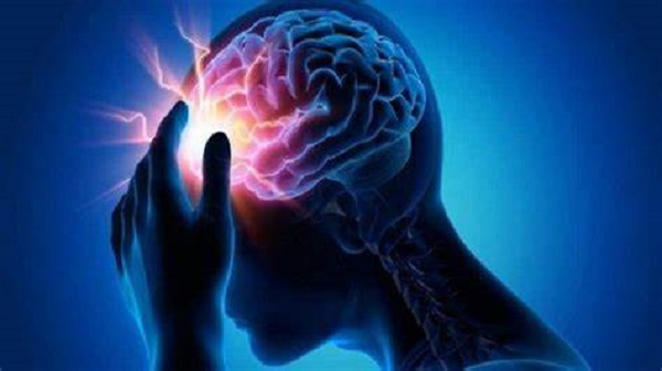 سکته مغزی در بسیاری از مبتلایان به کرونا دیده می‌شود