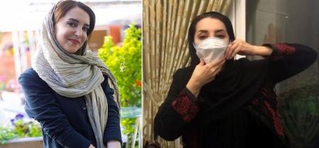 خطای پزشکی که منجر به فلج شدن فک بازیگر معروف شد