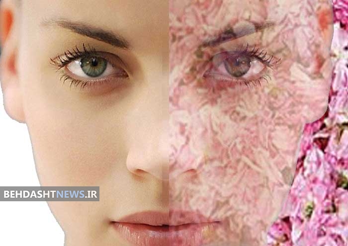  علائم بیماری لوپوس را بشناسیم 