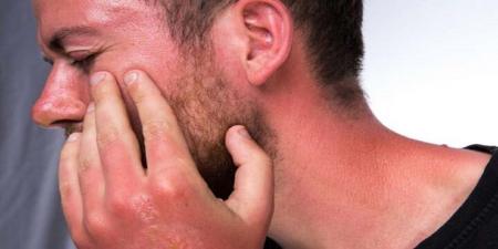 این کارها را بعد از آفتاب سوختگی 