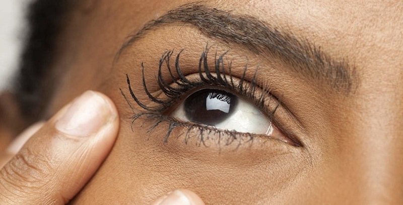 رایج‌ترین دلیل ریزش مژه چیست؟