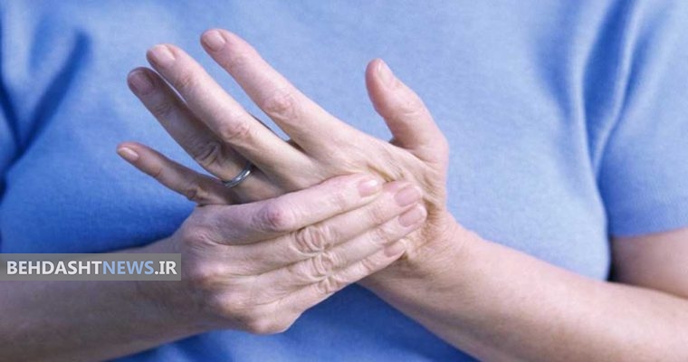 از آرتریت سوریاتیک و علائم آن بیشتر بدانید