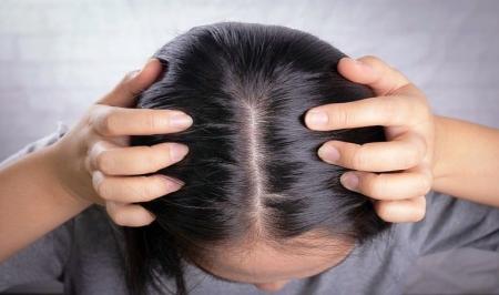 راه های جلوگیری از چرب شدن مو
