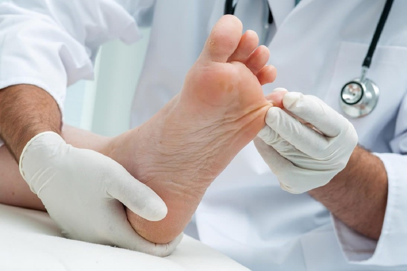 هشت راه طبیعی برای تسکین درد انحراف شست پا