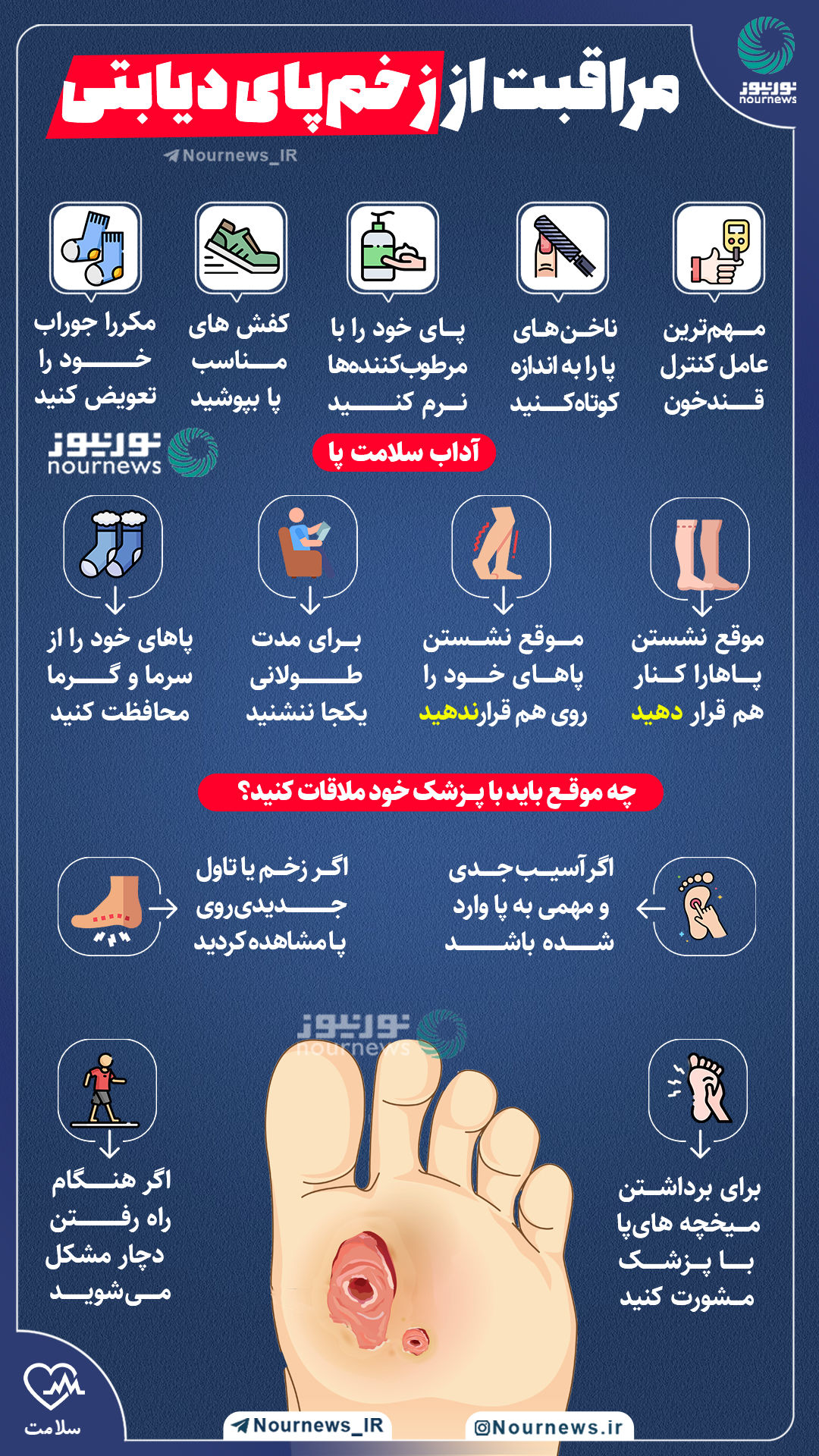 اینفوگرافیک/ نکاتی درباره مراقبت از زخم پای دیابتی