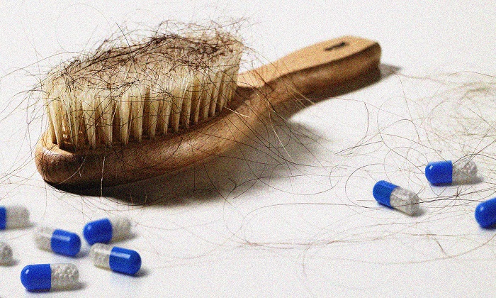 مجوز داروی درمان ریزش موی ایرانی صادر شد