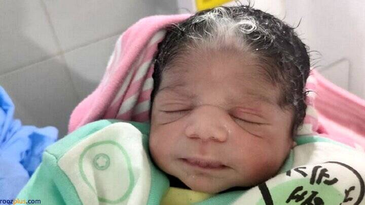تولد نوزادی نادر و عجیب با موهای سفید + عکس