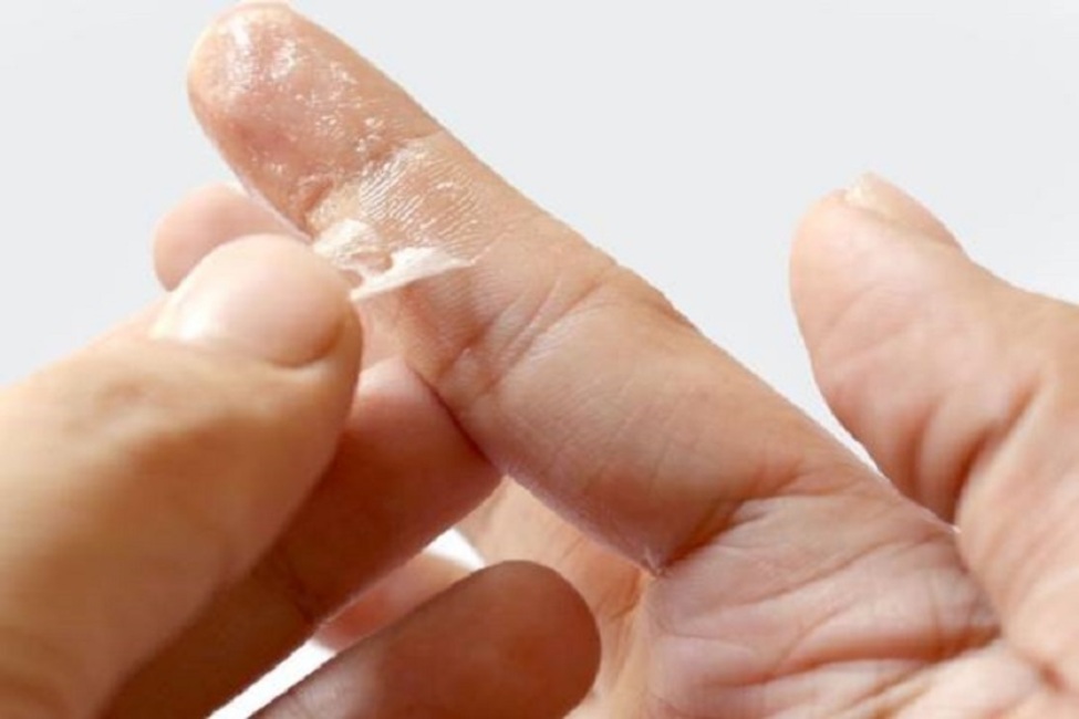 چند روش فوری برای پاک کردن چسب قطره‌ای از روی دست