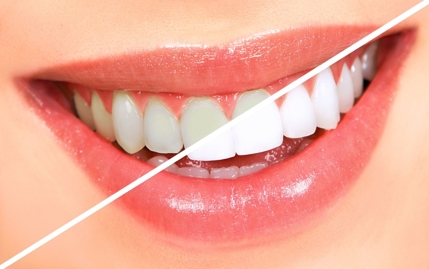 دندانپزشکی زیبایی چیست و چه خدماتی ارائه می دهد؟