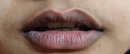 تغییر رنگ لب‌ها و اسرار آن