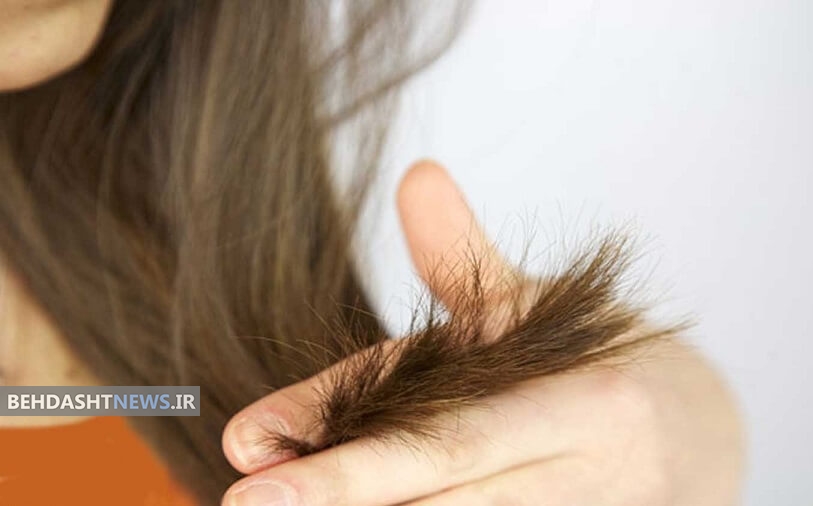  ناگفته هایی برای جلوگیری از ایجاد موخوره + اینفوگرافیک