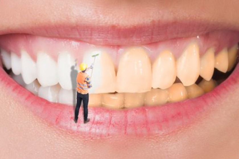 چگونه دندان پزشک ماهر ایرانی را تشخیص دهیم؟