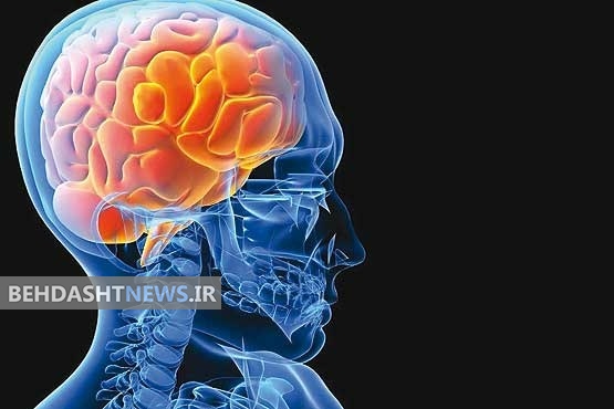نشانه‌های هشدار دهنده سکته مغزی