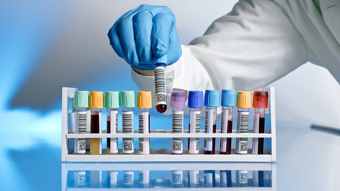 خدمات آزمایشگاهی از پوشش بیمه خارج نشده است