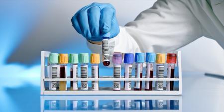 خدمات آزمایشگاهی از پوشش بیمه خارج نشده است