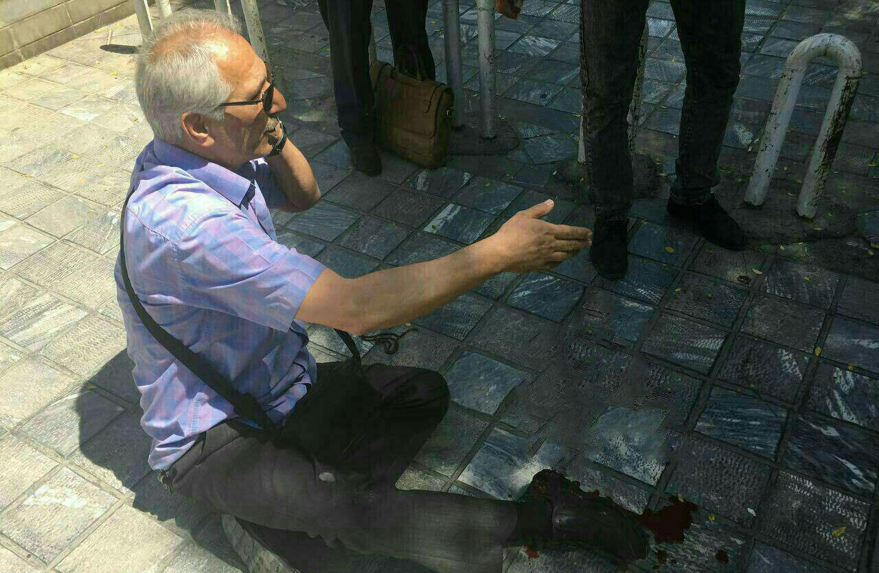 یکی از مجروحان حادثه تروریستی اطراف مجلس + عکس