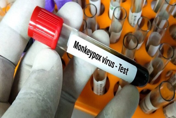 وزارت بهداشت: مورد مشکوکی از آبله میمونی در کشور مشاهده نشده است/ راه انتقال این ویروس