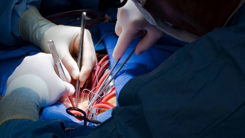 نخستین عمل جراحی تعویض دریچه آئورت قلب در شاهرود