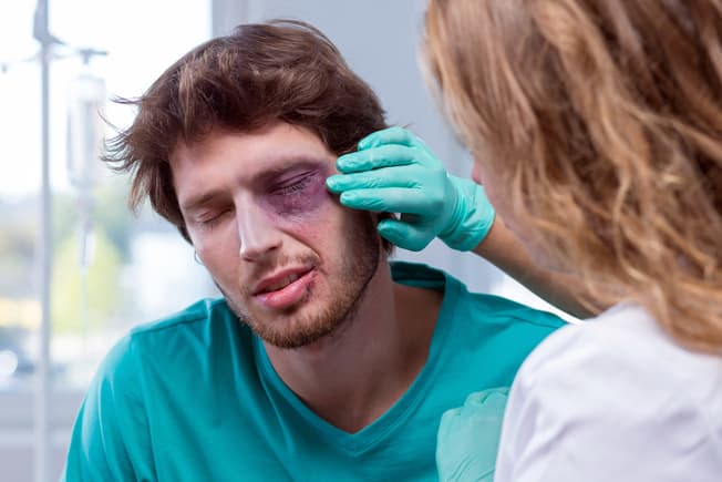 علت افتادگی پلک چشم چیست و چطور درمان می‌شود؟