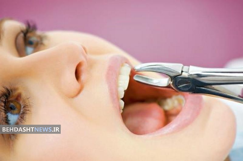 بعد از کشیدن دندان چه باید کرد؟