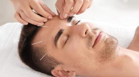 طب سوزنی در کاهش سردردهای تنشی موثر است