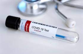 انجام تست  PCR در بیماران بدون علائم بالینی کووید-19 واجب است؟
