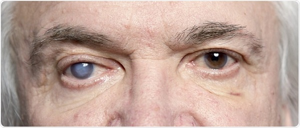 روش های تغذیه ای که از پیشرفت بیماری های چشمی در سنین بالا جلوگیری می کند 