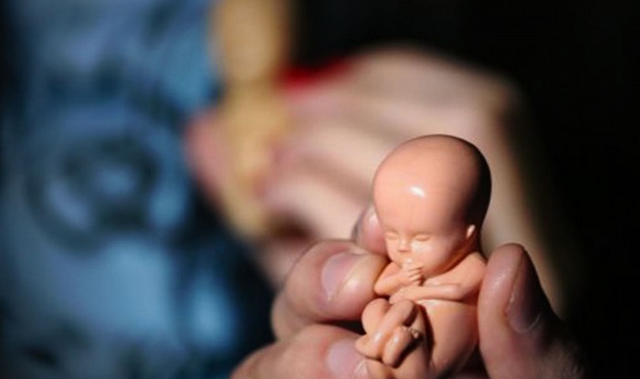واکنش وزارت بهداشت به نامه برخی انجمن های پزشکی  درمورد غربالگری جنین