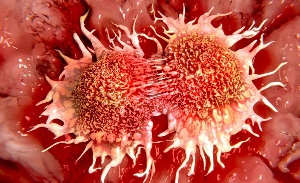 روشی جدید برای درمان سرطان؛ متوقف شدن رشد تومورها با قرار گرفتن در معرض سرما !