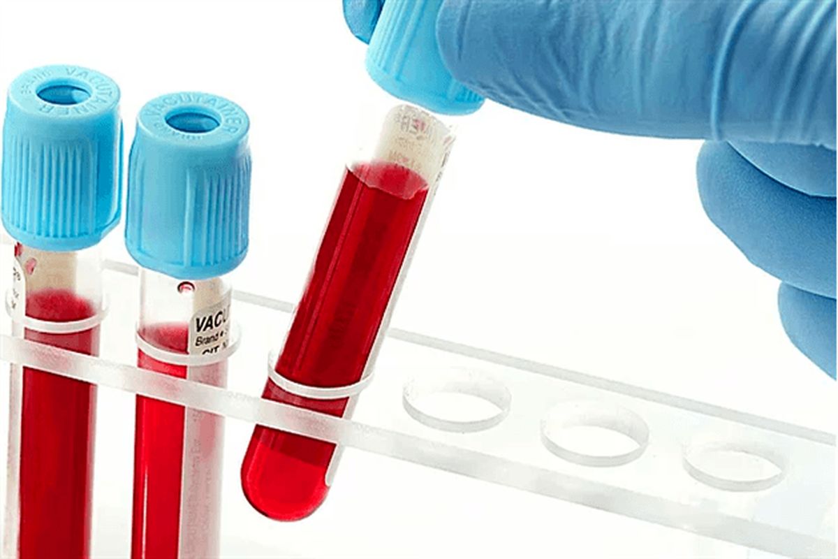 جمع آوری ۱۷۵ هزار نمونه خون بند ناف در کشور